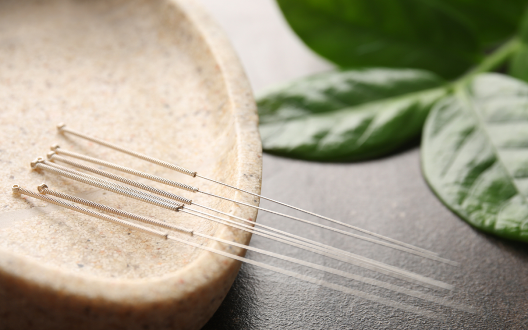 Acupuntura associada a psicoterapia